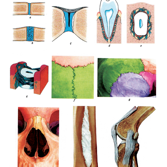 Artrosindesmologi&yacute;a.